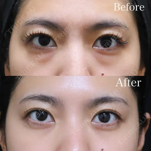 Wクリニック 福岡院の症例