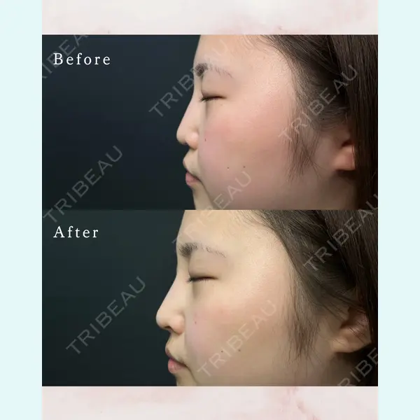 ルラ美容クリニック 東京駅前院 山本 泰輔医師の症例