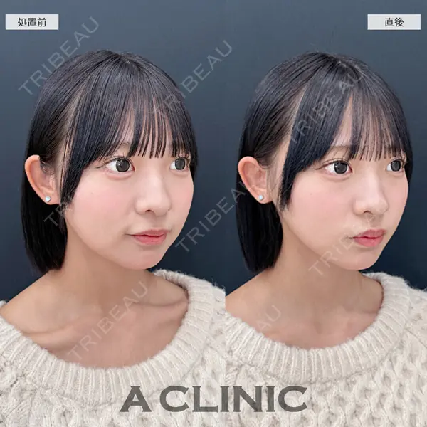 A CLINIC（エークリニック） 池袋院 三橋 克之医師の症例