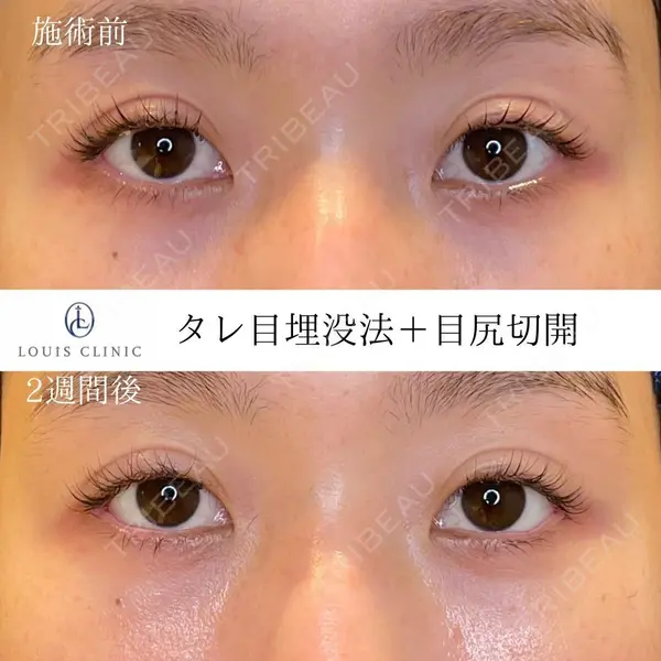 LOUIS CLINIC 二子玉川院【ルイクリニック】 小松 塁医師の症例