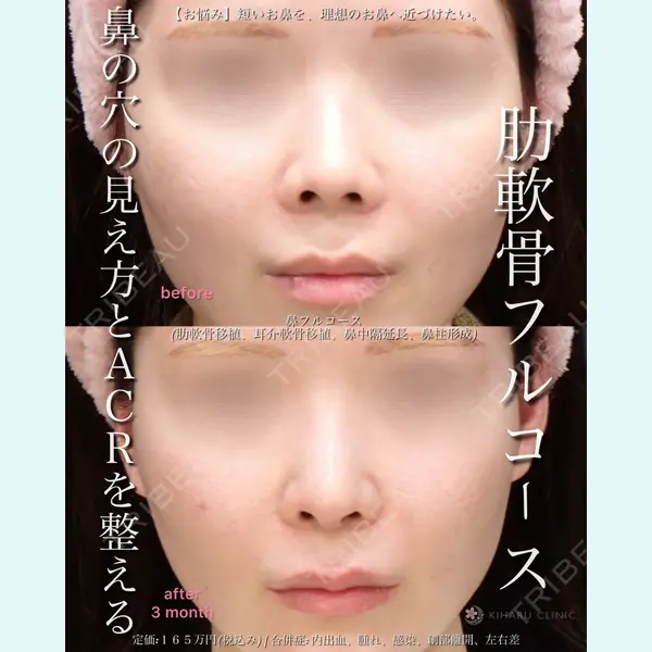 KIHARU CLINIC 沖野 尚秀医師の症例