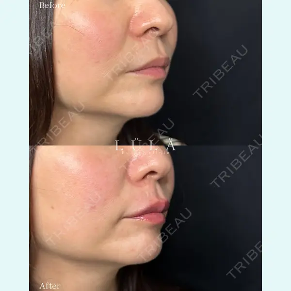 ルラ美容クリニック 町田院 松岡 舟作医師の症例