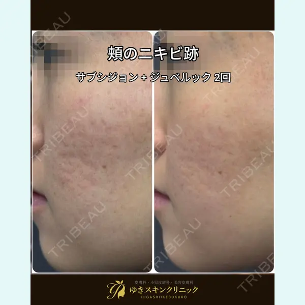 ゆきスキンクリニック 東池袋 小林 智之医師の症例