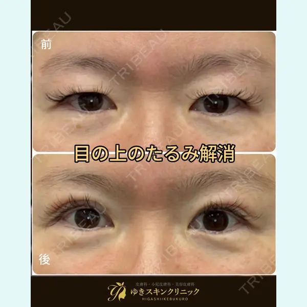 ゆきスキンクリニック 東池袋 小林 智之医師の症例