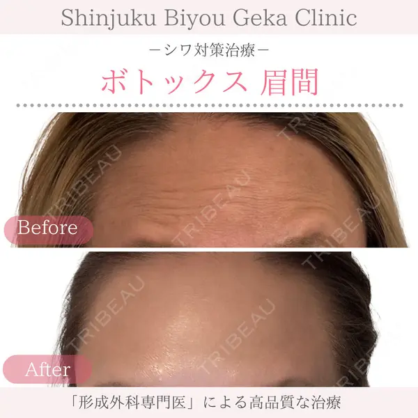 新宿美容外科クリニック 立川院 戸枝 幹夫医師の症例