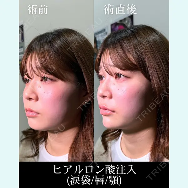HAAB×DREAM BEAUTY CLINIC 大阪梅田院 錦 実奈医師の症例