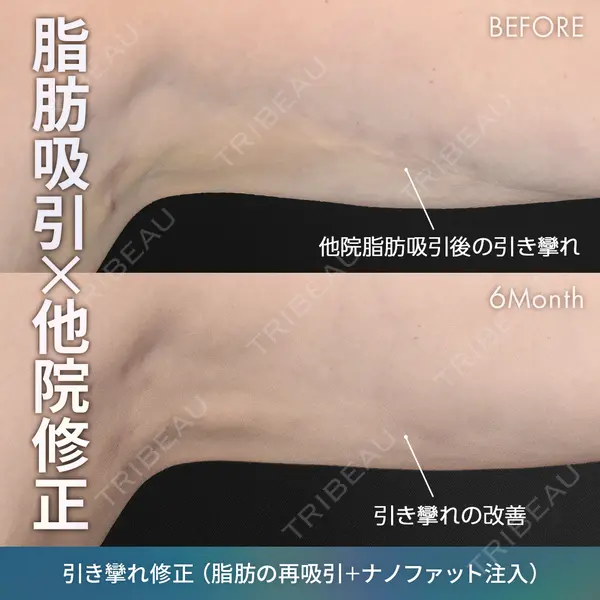 ジョウクリニック 銀座院 重本　譲医師の症例