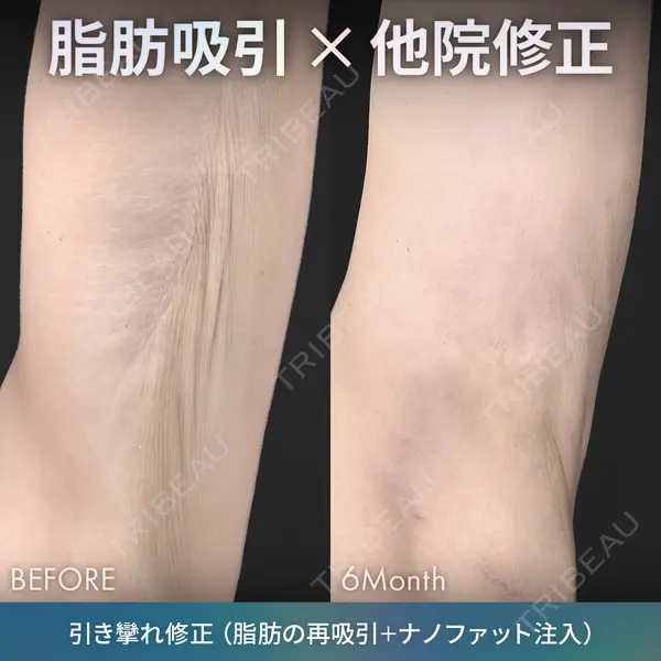 ジョウクリニック 銀座院 重本　譲医師の症例