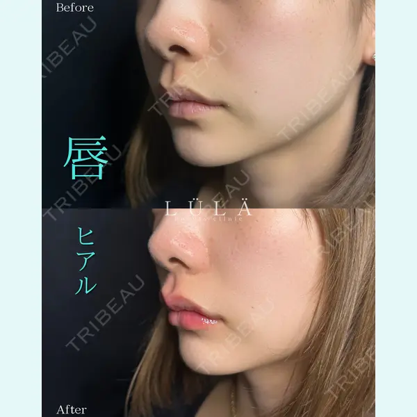 ルラ美容クリニック 町田院 松岡 舟作医師の症例