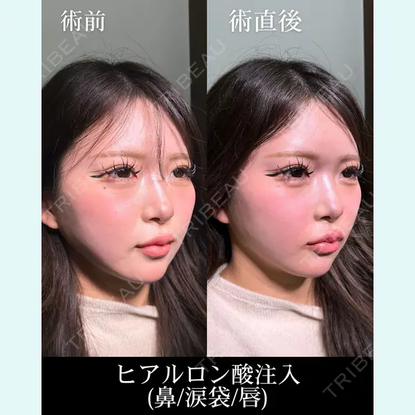 HAAB×DREAM BEAUTY CLINIC 大阪梅田院 錦 実奈医師の症例