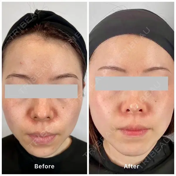 oneUPclinicの症例