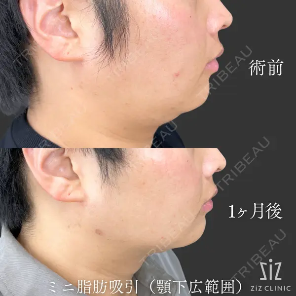 ziz CLINIC 村岡 史子医師の症例
