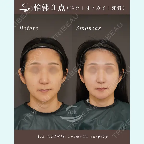 アーククリニック 加藤 雄大医師の症例