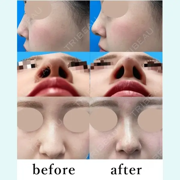 大塚美容形成外科 札幌院 武田 昇医師の症例