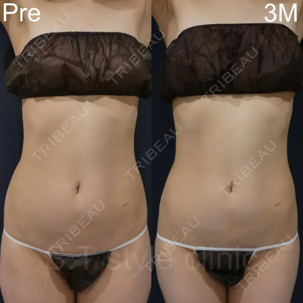 S.T styleクリニック 徳田 真紀子医師の症例