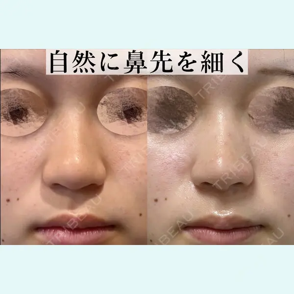 東京美専クリニック 大井惇医師の症例