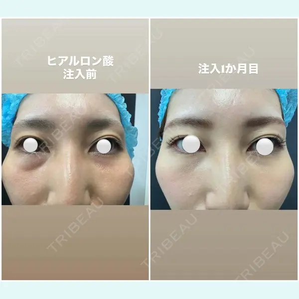 大塚美容形成外科 札幌院 武田 昇医師の症例