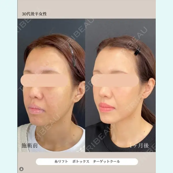 自由が丘ウェルエイジングビューティークリニック 福田 知佐子医師の症例