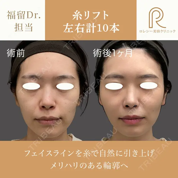 ロレシー美容クリニック 心斎橋駅前院 福留院長医師の症例