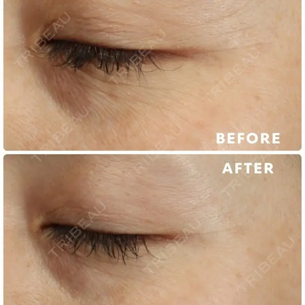 渋谷DSクリニック 渋谷院の症例