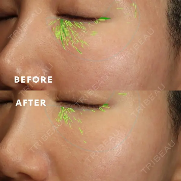 渋谷DSクリニック 渋谷院の症例