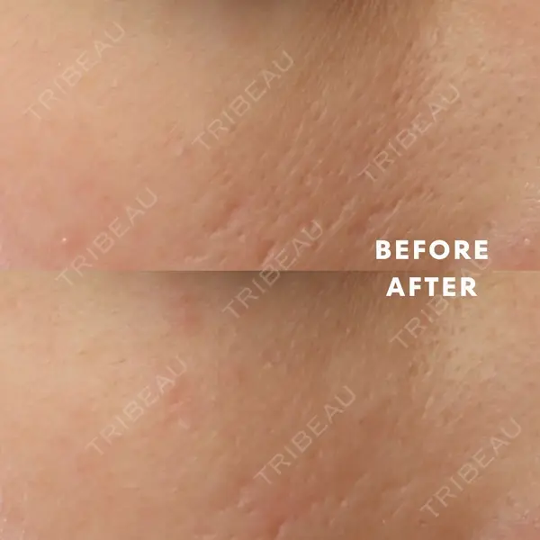 渋谷DSクリニック 渋谷院の症例