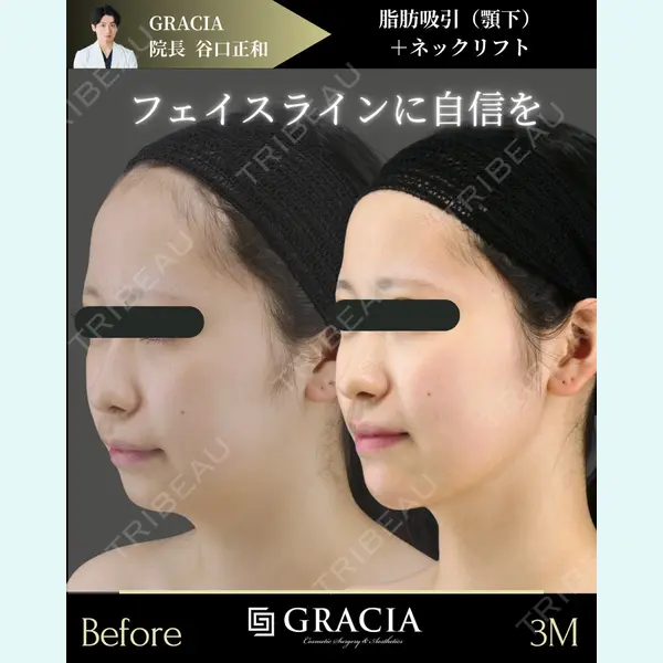 GRACIA clinic 【グラシアクリニック】 谷口　正和医師の症例