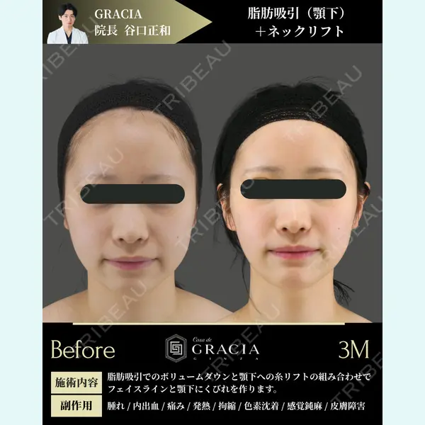 GRACIA clinic 【グラシアクリニック】 谷口　正和医師の症例