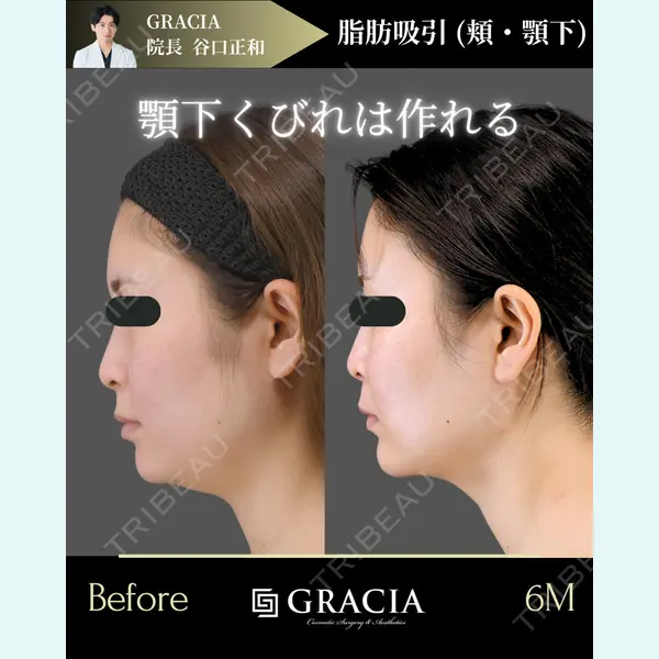 GRACIA clinic 【グラシアクリニック】 谷口　正和医師の症例