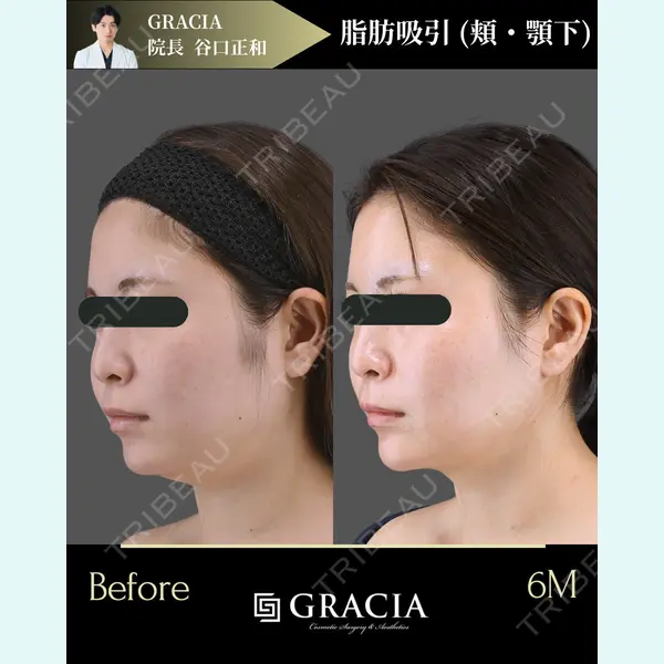 GRACIA clinic 【グラシアクリニック】 谷口　正和医師の症例