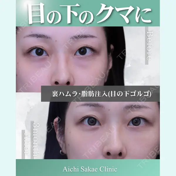 あいちビューティークリニック栄本院の症例