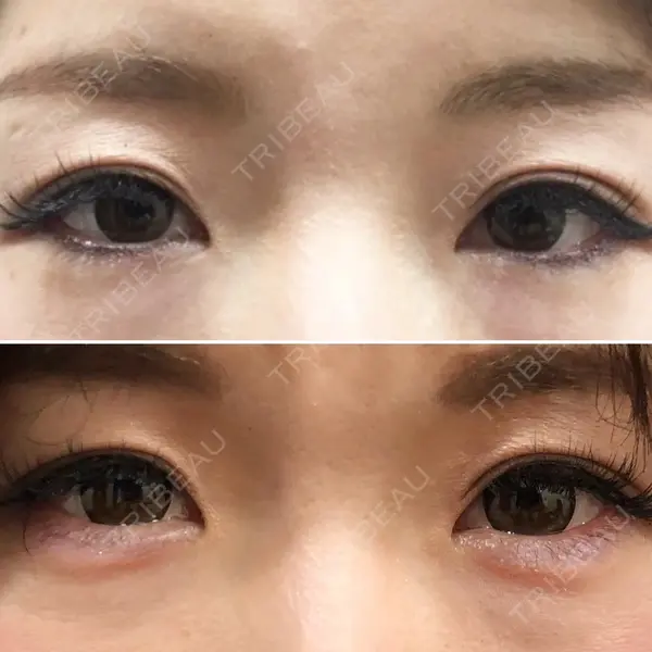 しのぶ皮膚科 蘇原しのぶ医師の症例