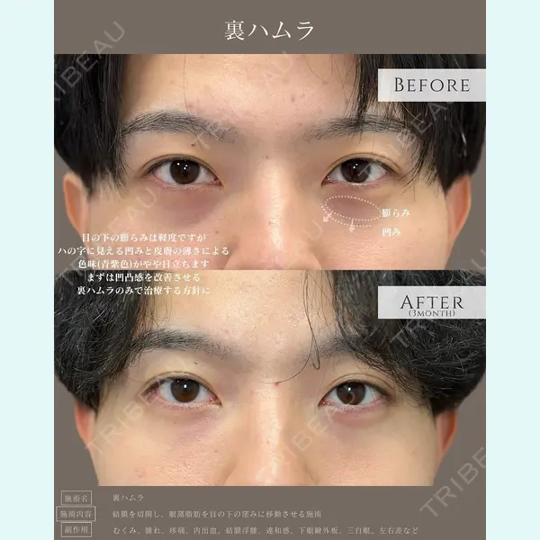 eクリニック 名古屋院 服部 健人医師の症例