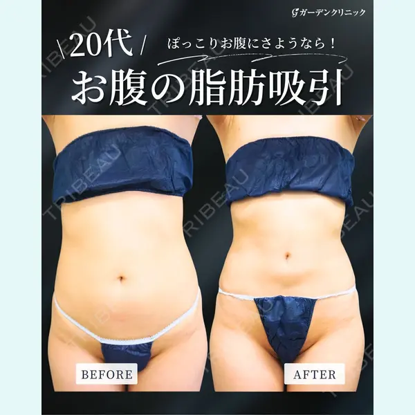 ガーデンクリニック 大阪院 松口 崇央医師の症例