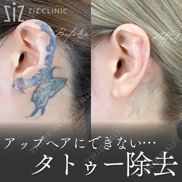 ziz CLINIC 村岡 史子医師の症例