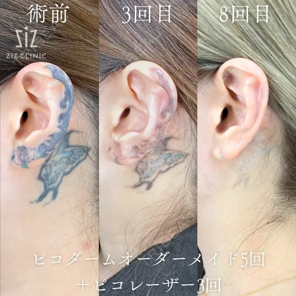 ziz CLINIC 村岡 史子医師の症例