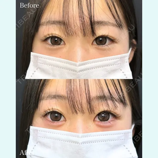 ルラ美容クリニック 名古屋本院 山本 美佳医師の症例