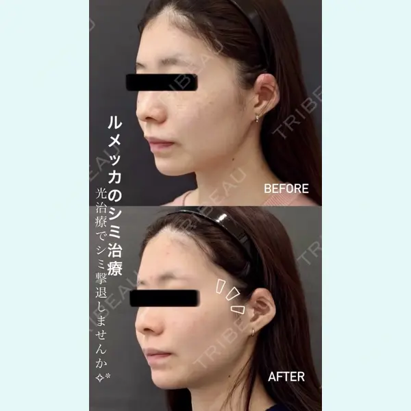 銀座美容外科クリニック 銀座院の症例