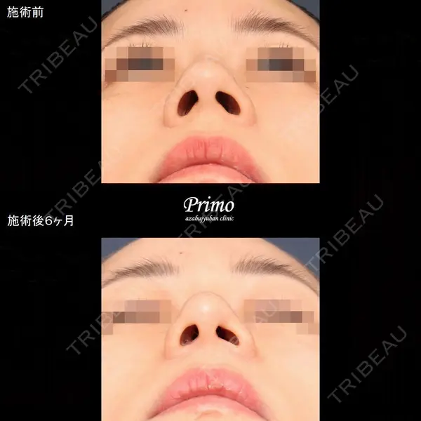 プリモ麻布十番クリニック 大場教弘医師の症例