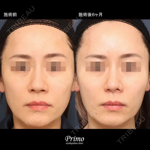 プリモ麻布十番クリニック 大場教弘医師の症例