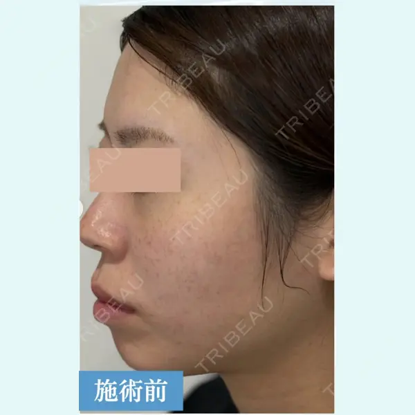 Y.CLINIC 肥田安紀子医師の症例