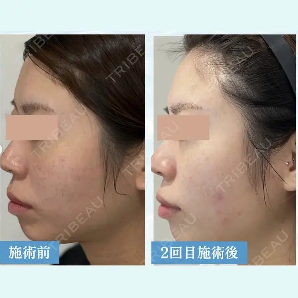 Y.CLINIC 肥田安紀子医師の症例