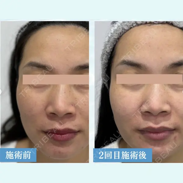 Y.CLINIC 肥田安紀子医師の症例