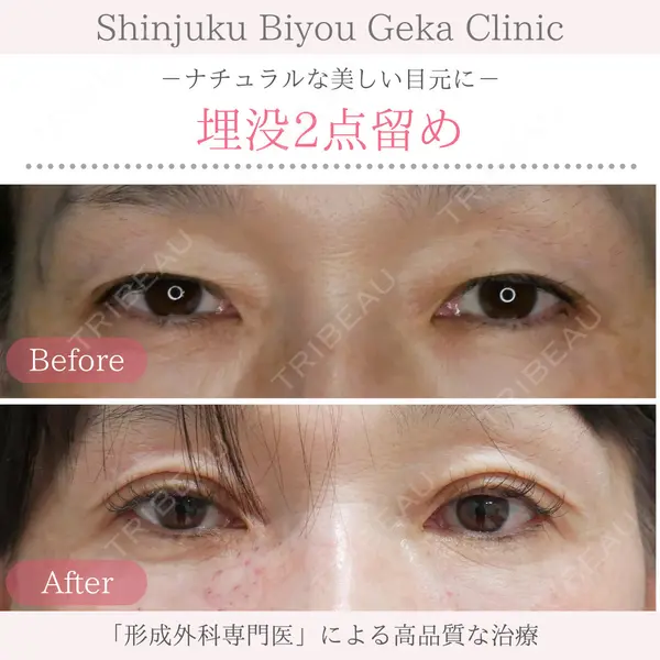 新宿美容外科クリニック 新宿院の症例