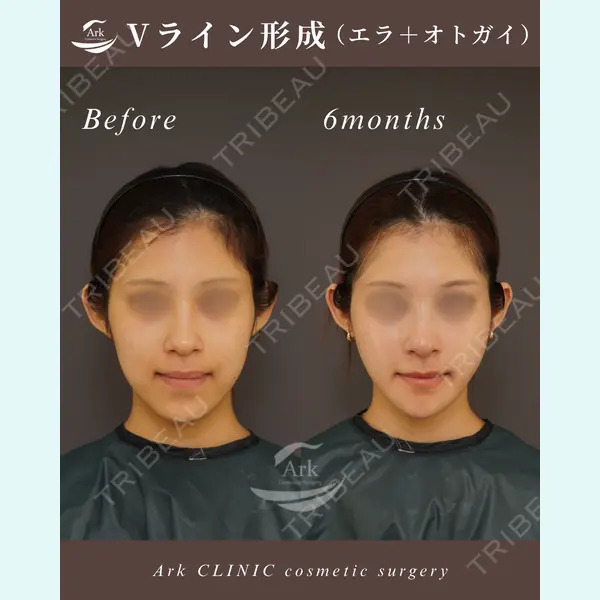 アーククリニック 加藤 雄大医師の症例