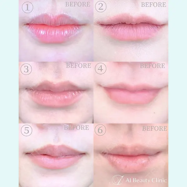 AI Beauty Clinic （エーアイ美容クリニック）の症例