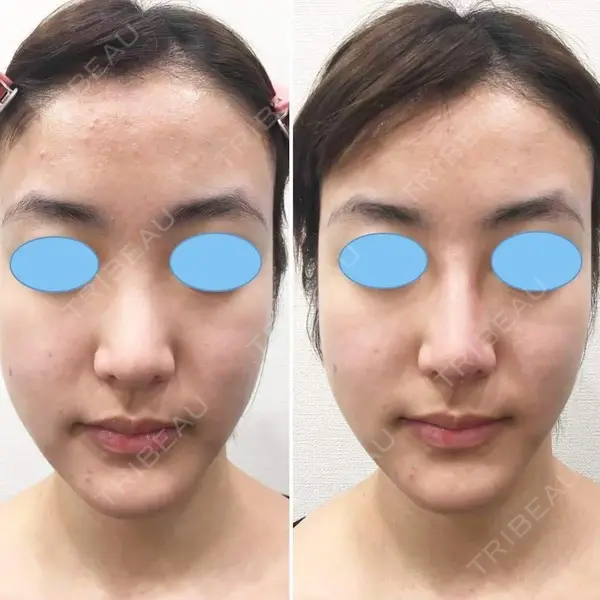 しのぶ皮膚科 蘇原しのぶ医師の症例