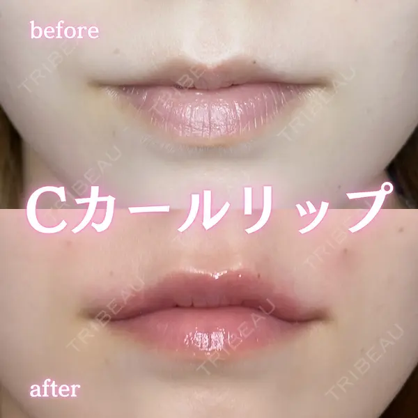 ルラ美容クリニック 新宿院 陶 美梨医師の症例