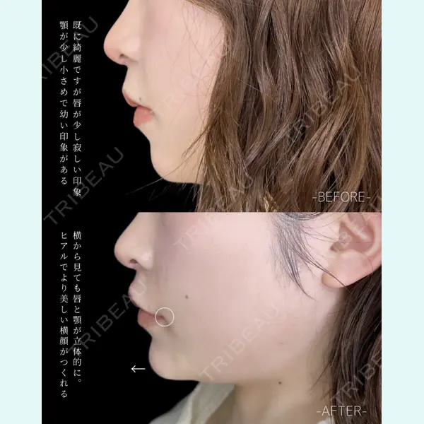 ルラ美容クリニック 大宮院 / ルラスキンクリニック 大宮院 右京 大季医師の症例