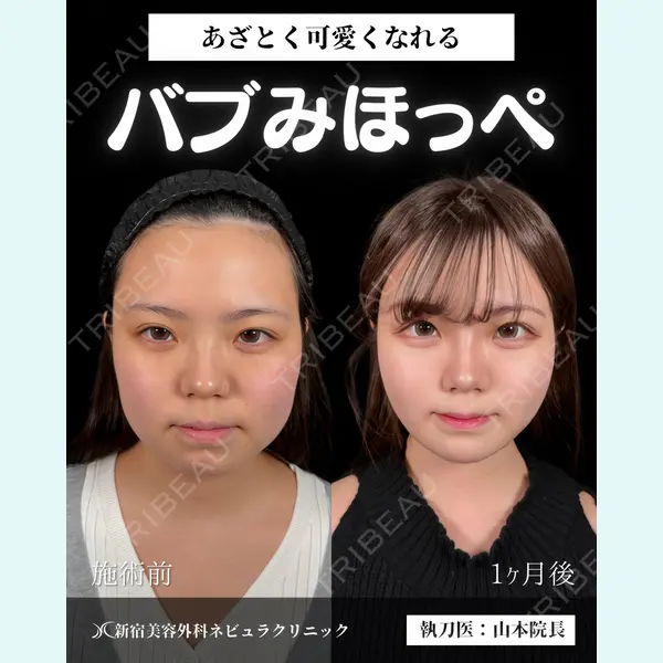 新宿美容外科ネビュラクリニック 山本 紘子医師の症例